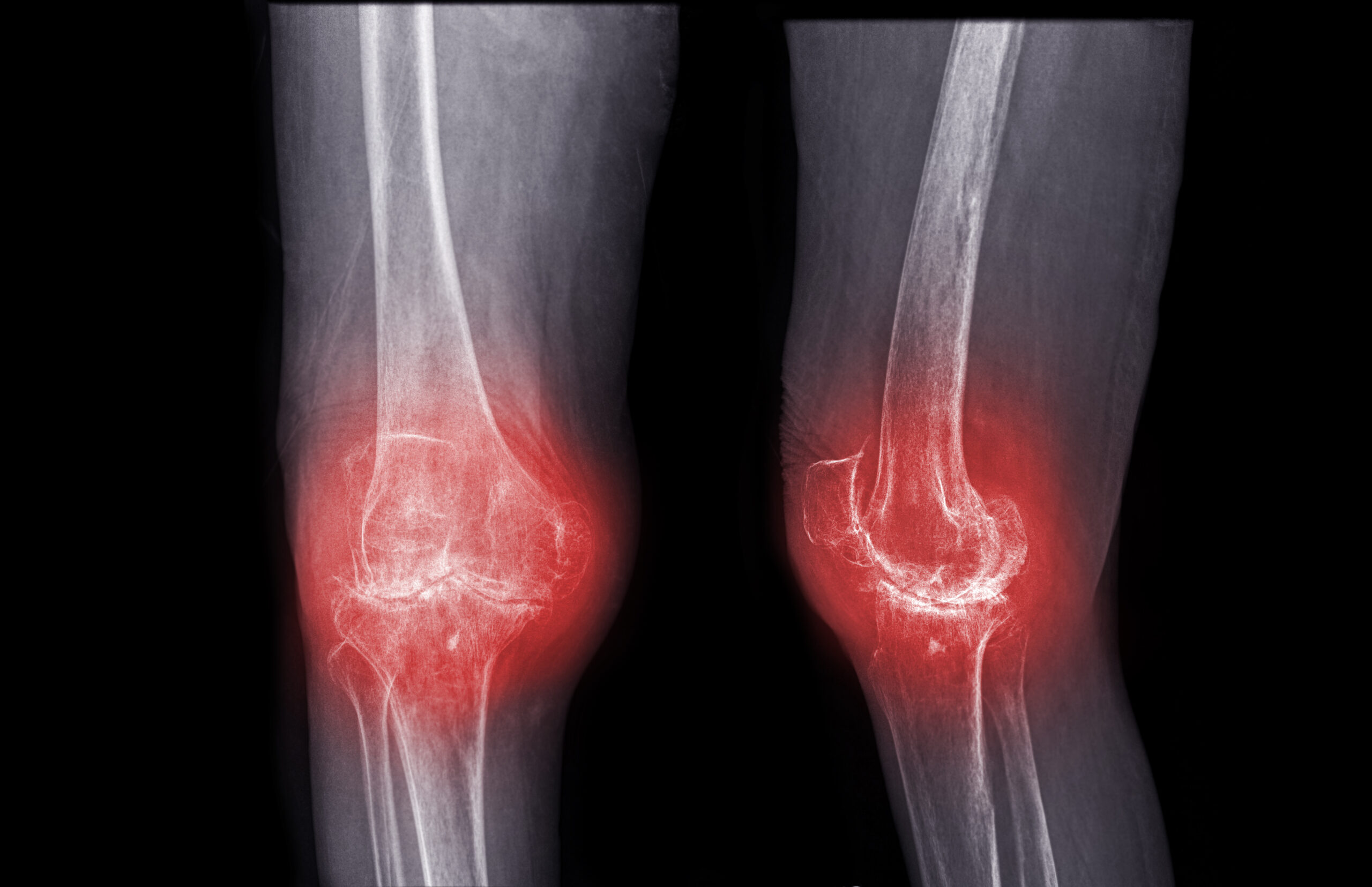 Cypress Pointe surgeons diagnose and treat various orthopedic